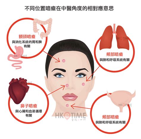 頸後生暗瘡|【暗瘡位置】不同代表什麼？中醫教如何處理及預防